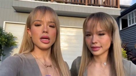 Beda Nasib Dea Onlyfans Dengan The Connel Twins Ini Kisah Si Gadis Beda Nasib Dea Onlyfans Dengan The Connel Twins Ini Kisah Si Gadis